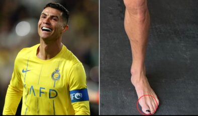 Cristiano Ronaldo neden oje sürüyor? Sebebini duyan şaşıracak…