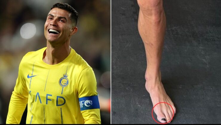 Cristiano Ronaldo neden oje sürüyor? Sebebini duyan şaşıracak…